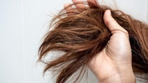 Read more about the article HAIR TREATMENT TIPS