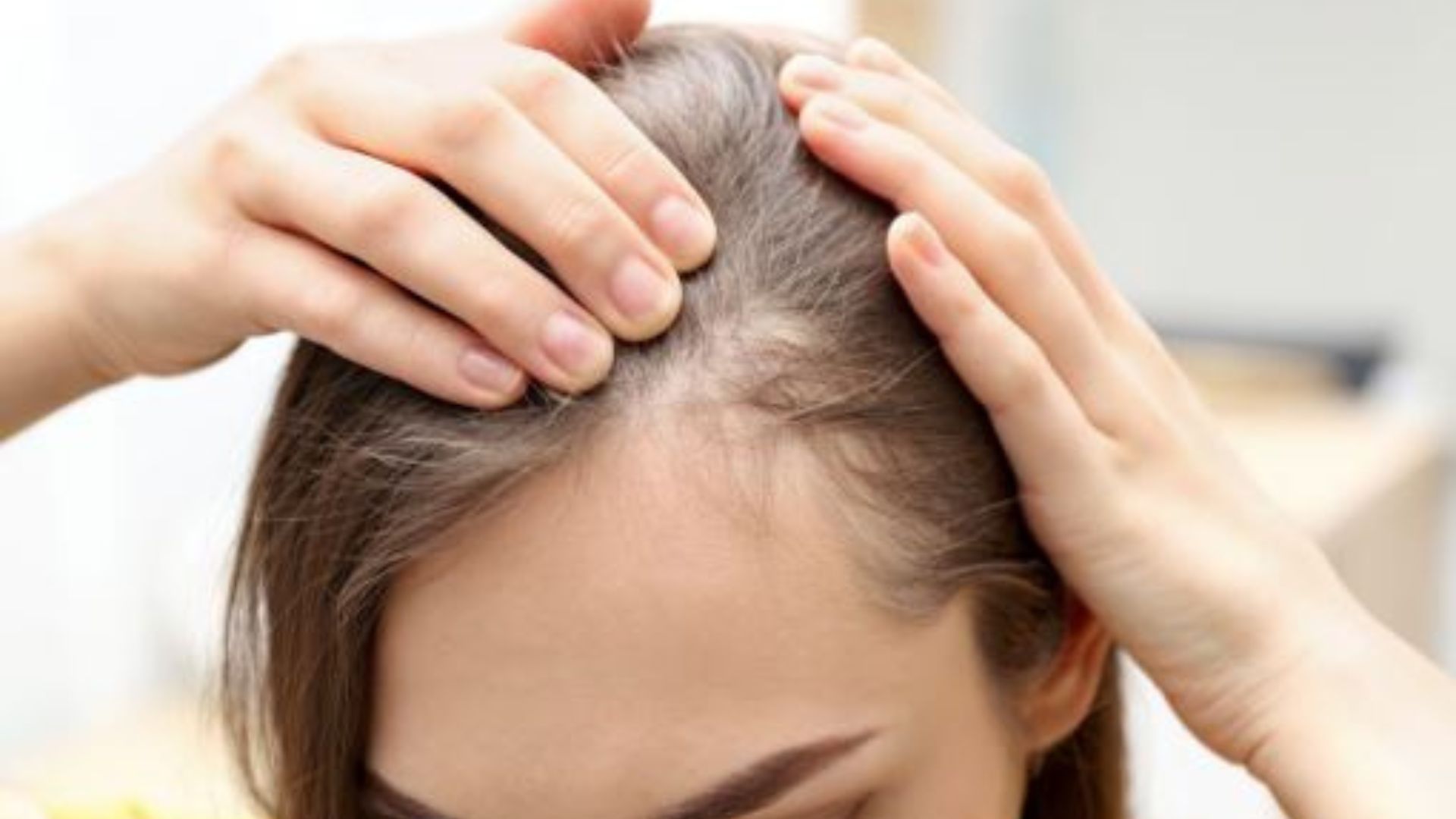 Read more about the article how to regrow hair on bald spot fast home remedies